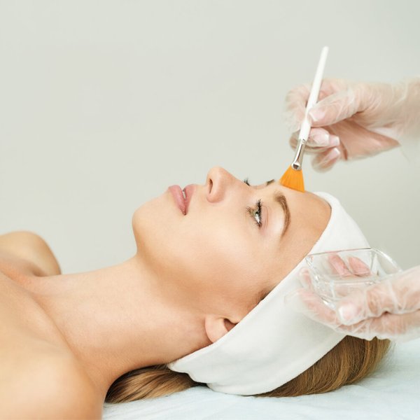 Peeling com ácido retinóico