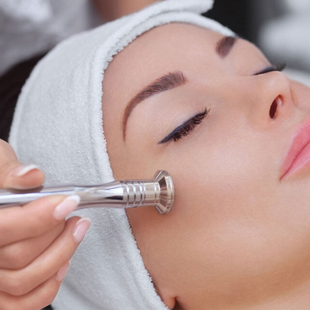 Peeling de diamante.jpg